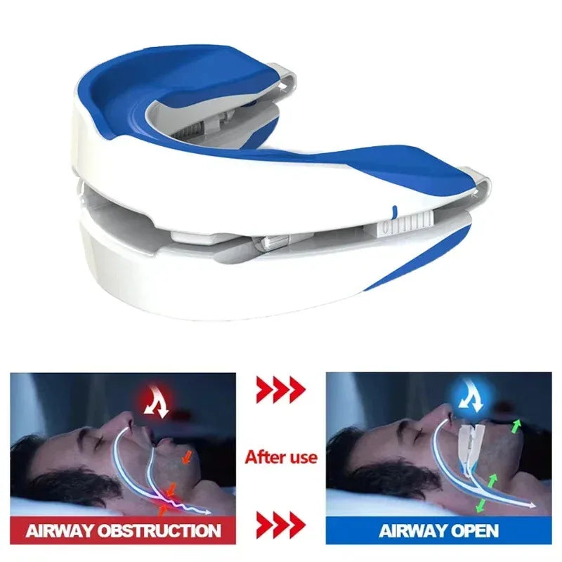 Adjustable Anti-Snoring Mouthpiece – Night Teeth Guard & Sleep Aid