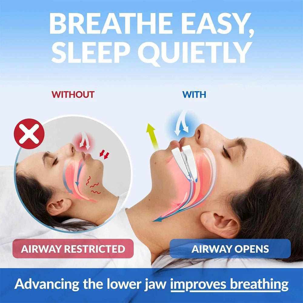 Adjustable Anti-Snoring Mouthpiece – Night Teeth Guard & Sleep Aid