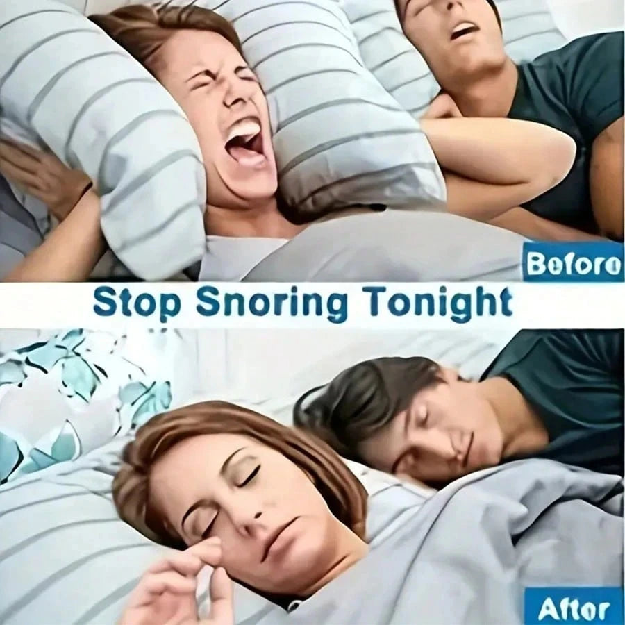 Anti-Snoring Nose Clip – Soft Nasal Dilator (2–10 Pack)